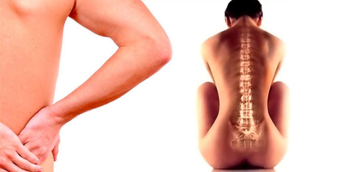 bol u donjem dijelu leđa zbog osteohondroze