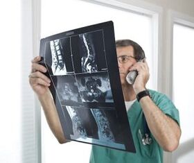 Mijelografija za dijagnozu osteohondroze i intervertebralne kile