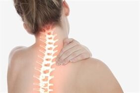 Cervikalna osteohondroza kod žena